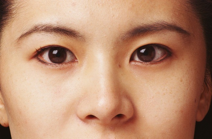 眉間ニキビのスピリチュアルな意味とは？眉毛付近の場所別に紹介